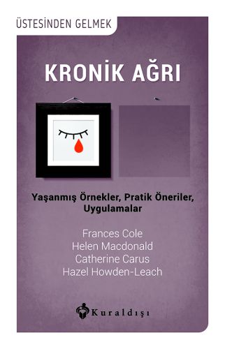 Kronik Ağrı %16 indirimli Helen Macdonald- Frances Cole