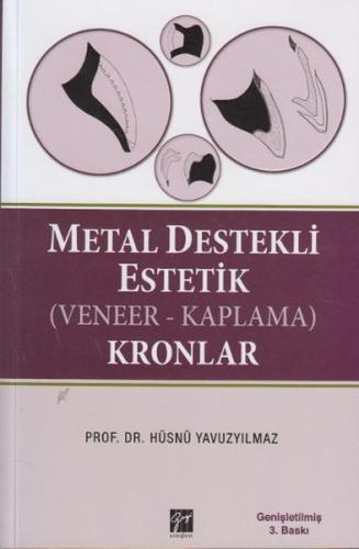 Metal Destekli Estetik (Veneer-Kaplama) Kronlar Hüsnü Yavuzyılmaz