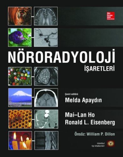 Nöroradyoloji İşaretleri (Ciltli) Ronald L. Eisenberg