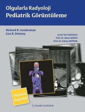 Olgularla Radyoloji / Pediatrik Görüntüleme %20 indirimli Richard B. G